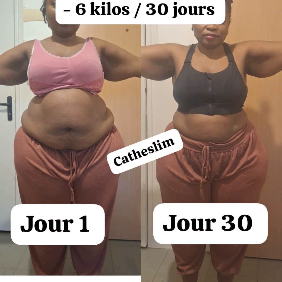 Produits et programmes minceur Catheslim